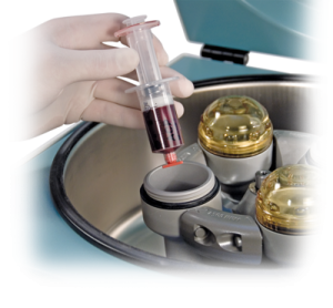 platelet_rich_plasma_0-large